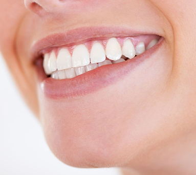 Fixing gaps Straightening teeth